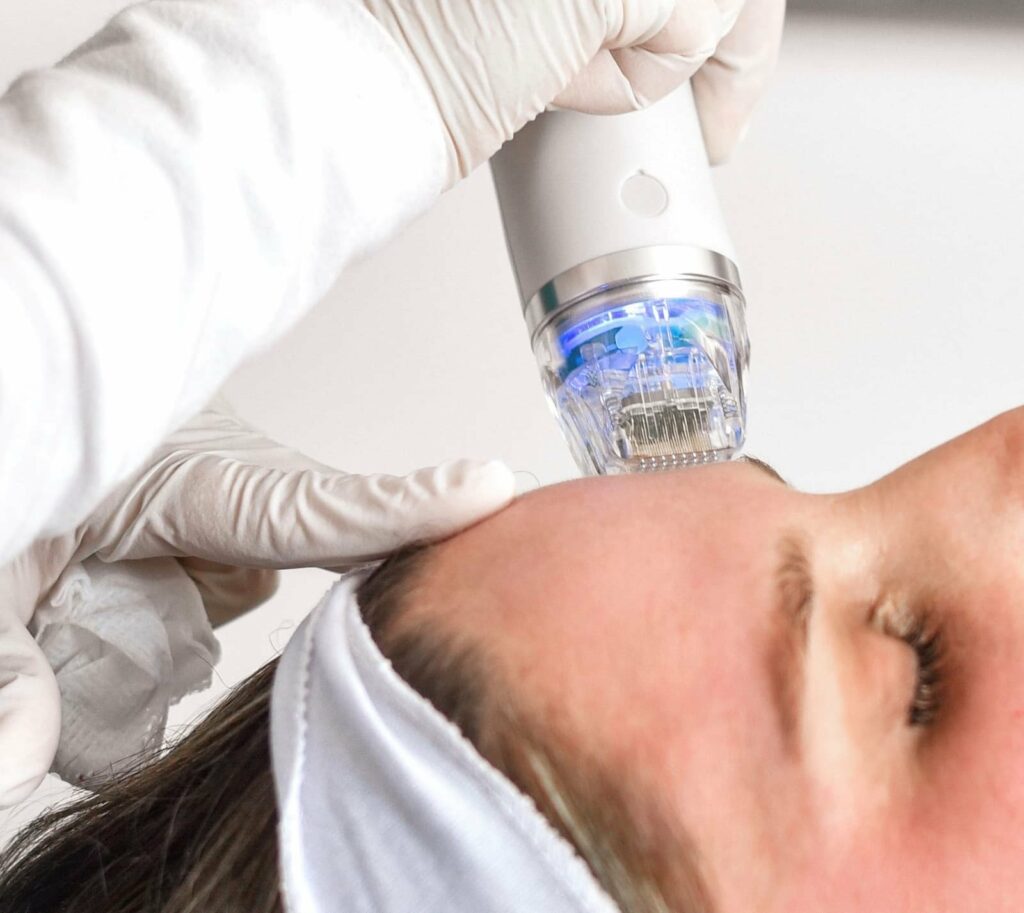 Enlarged Pores