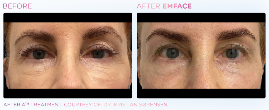 Emface_PIC_Ba-card-female-eyes-065_ENUS