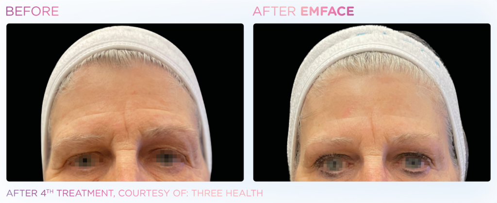 Emface_PIC_Ba-card-female-face-086_ENUS100