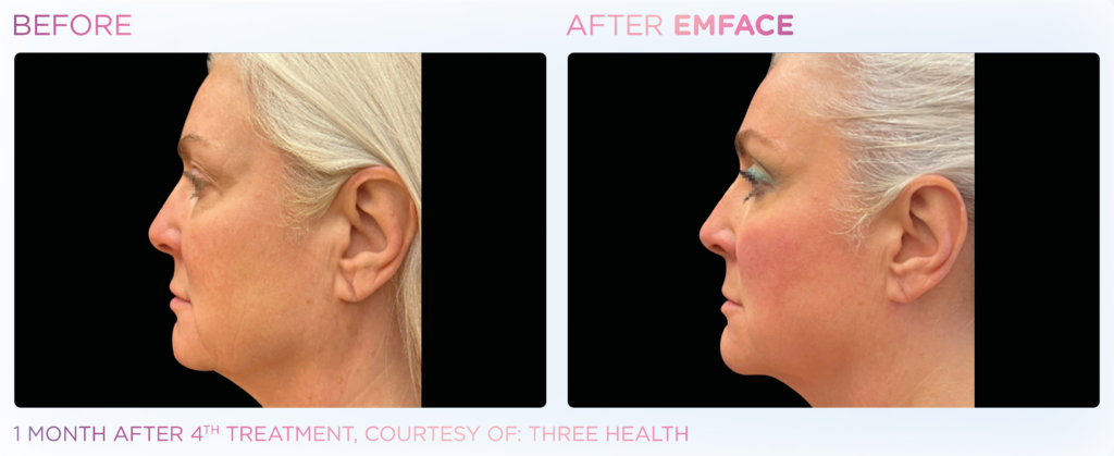 Emface_PIC_Ba-card-female-face-087