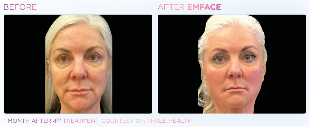 Emface_PIC_Ba-card-female-face