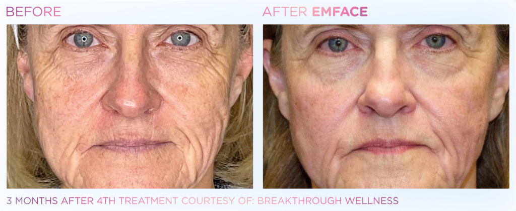 Emface_PIC_Ba-card-female-face-102_ENUS