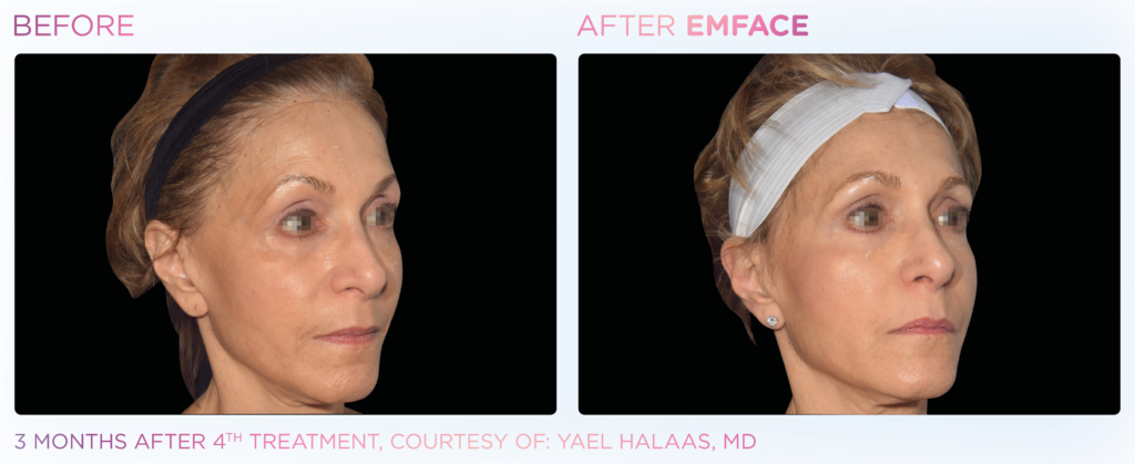 Emface_PIC_Ba-card-female-face-104_ENUS