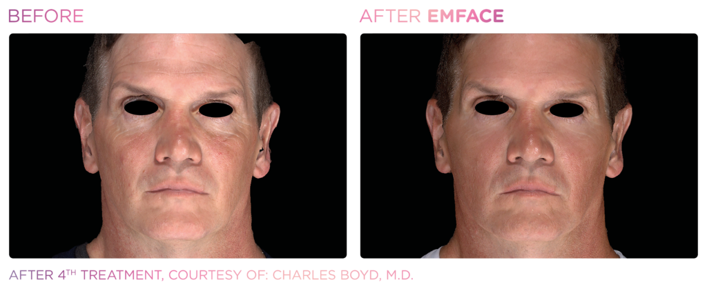 Emface_PIC_Ba-card-male-face