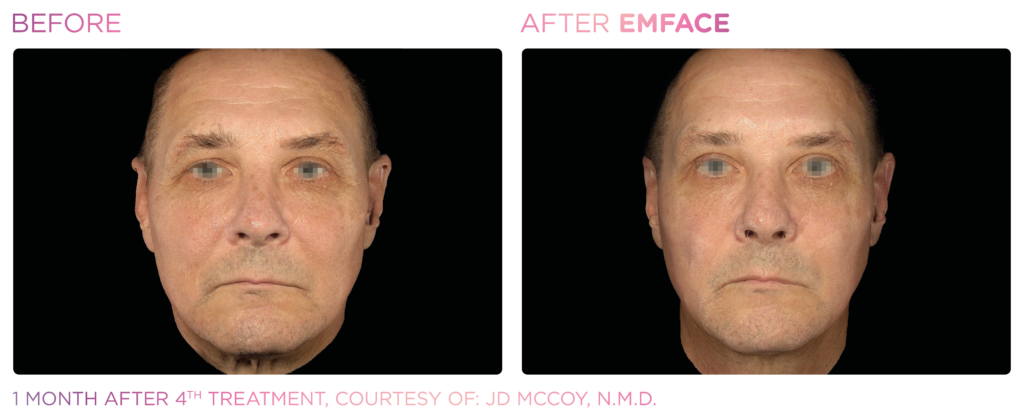 Emface_PIC_Ba-card-male-face-073_ENUS