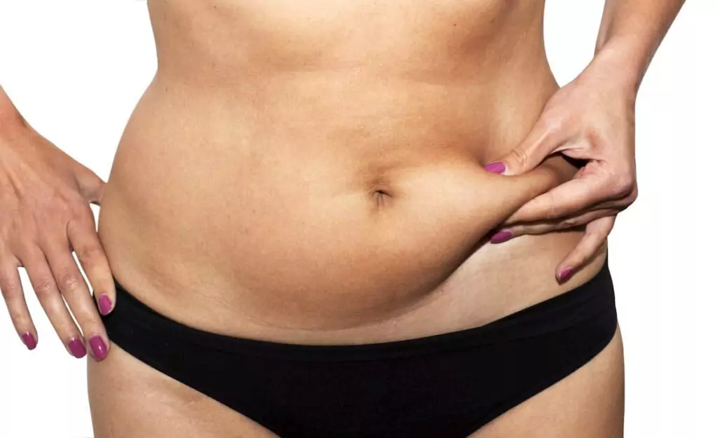 Stubborn Fat Removal NZ